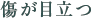 傷が目立つ