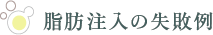 脂肪注入の失敗例