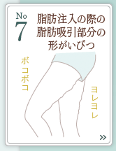 7位 吸引部位の形がいびつ