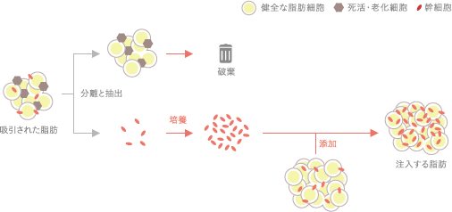 セルチャー豊胸の注入脂肪の作り方