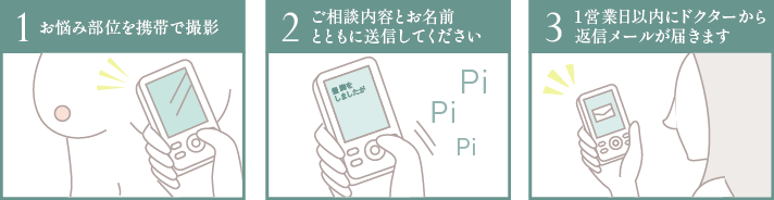 1.お悩み部位を携帯で撮影／2.ご相談内容とお名前とともに送信してください／3.数日後ドクターから返信メールが届きます