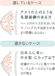 適しているケース／適さないケース